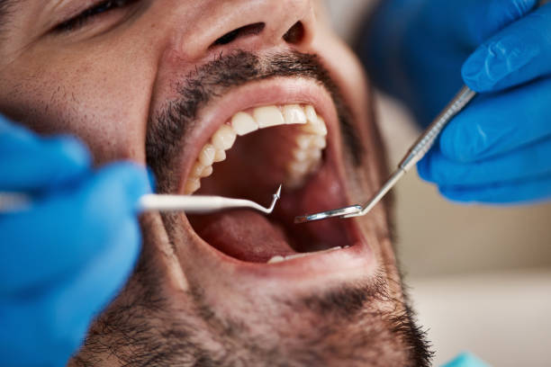 Best Emergency Broken Tooth Repair in Burke Centre, VA