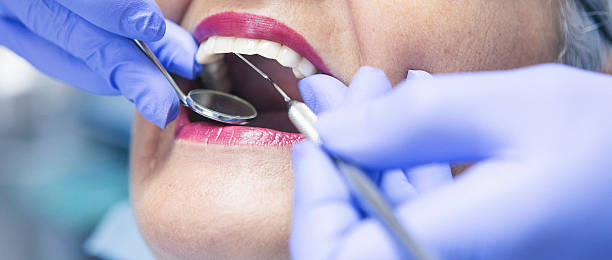 Best Emergency Tooth Extraction in Burke Centre, VA